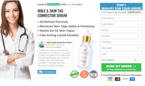 Amarose Skin Tag Remover: [Fact Check] “Alert Reviews” Shocking New Report May Change Your Mind!