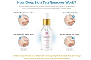 Amarose Skin Tag Remover Work